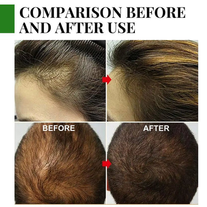 Rosemary Essential Oil for Hair Growth 